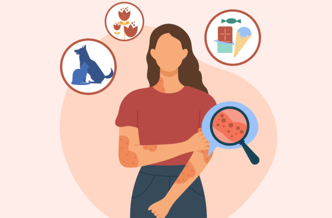 Siproheptadin (Cyproheptadine)